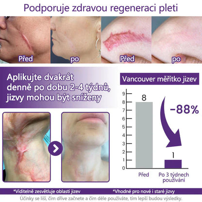ReGenScar Advanced Scar Repair Gel