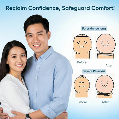 SmoothCare Gel (Redundant Prepuce Corrector Gel)